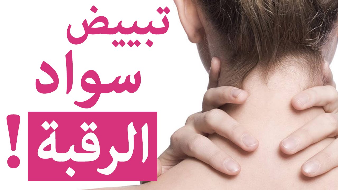 ما علاج سواد الرقبه